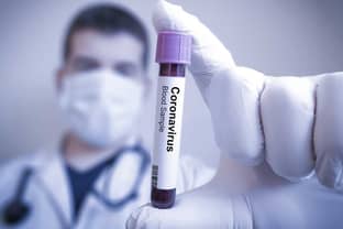 Coronavirus in de fashion: wees alert, reageer direct